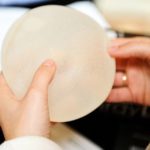 How to Prepare for Your Breast Augmentation Consultation