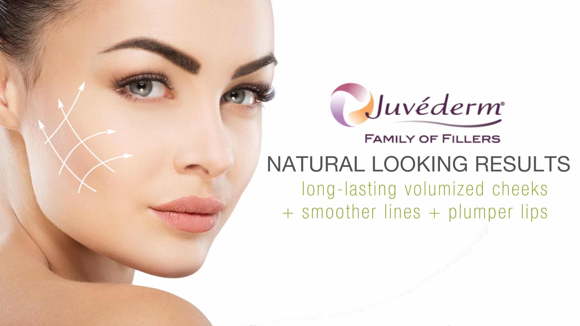 Juvederm is FDA-approved for the temporary correction of moderate to severe facial wrinkles and folds.