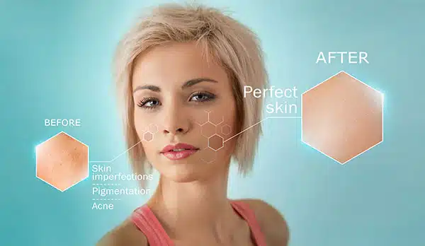 why skip laser treatments