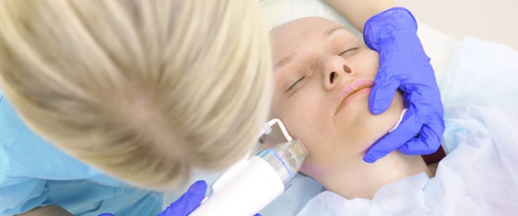 Dr. Ran Rubinstein offers microneedling using the Genius RF device.