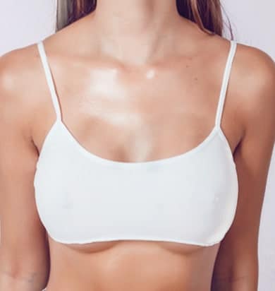 Breast Augmentation