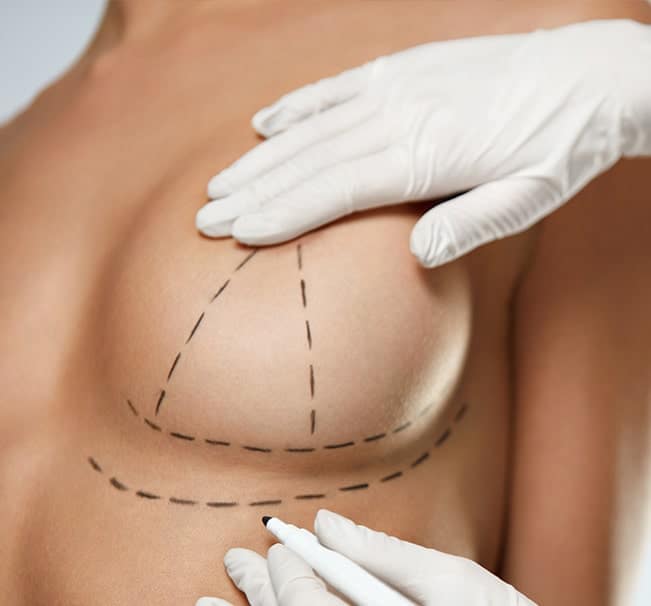 Over the years breasts can lose their shape and firmness due to pregnancy, nursing and loss of skin elasticity, causing them to sag