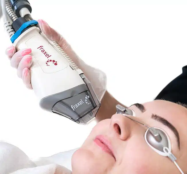 The Fraxel laser is a type of fractional laser skin resurfacing device. 