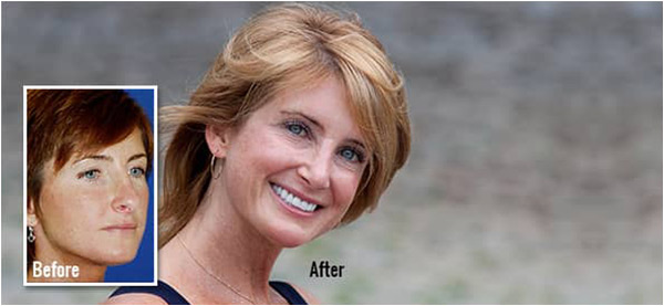 Featured Patient