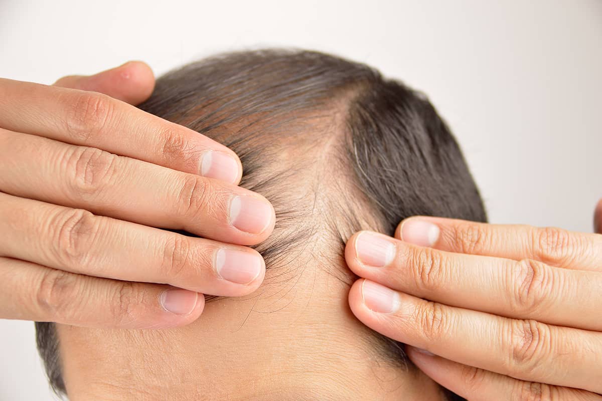 A combination of treatments may be prescribed to meet a patient's aesthetic goals, including LLLT and PRP hair restoration for healthy follicles, and FUT or FUE for inactive follicles