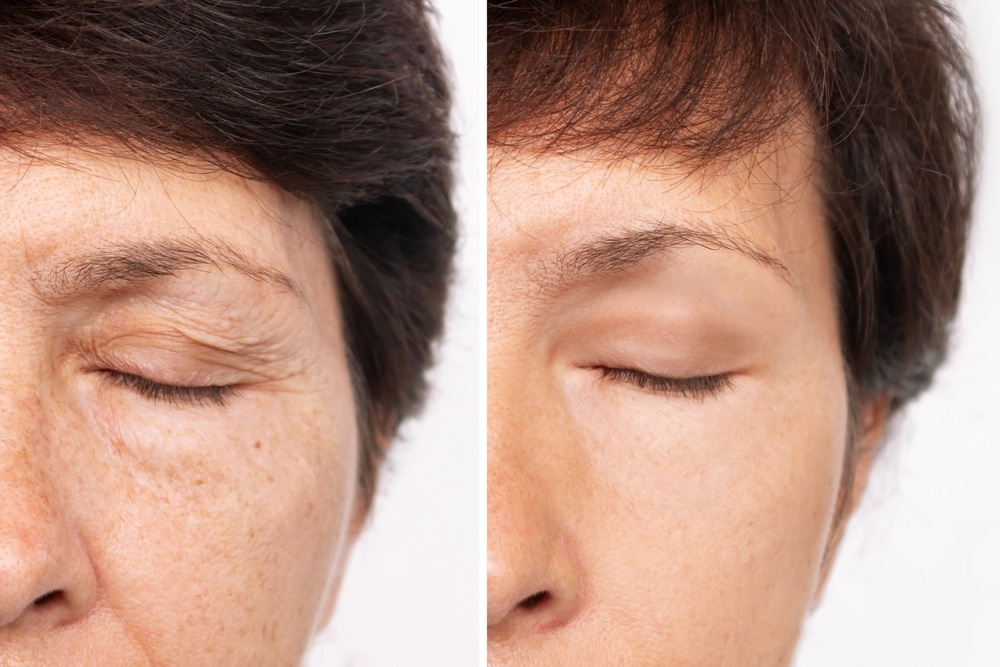 Be aware of these signs and consult with Dr. Rubinstein on how to deal with puckering and tightness.