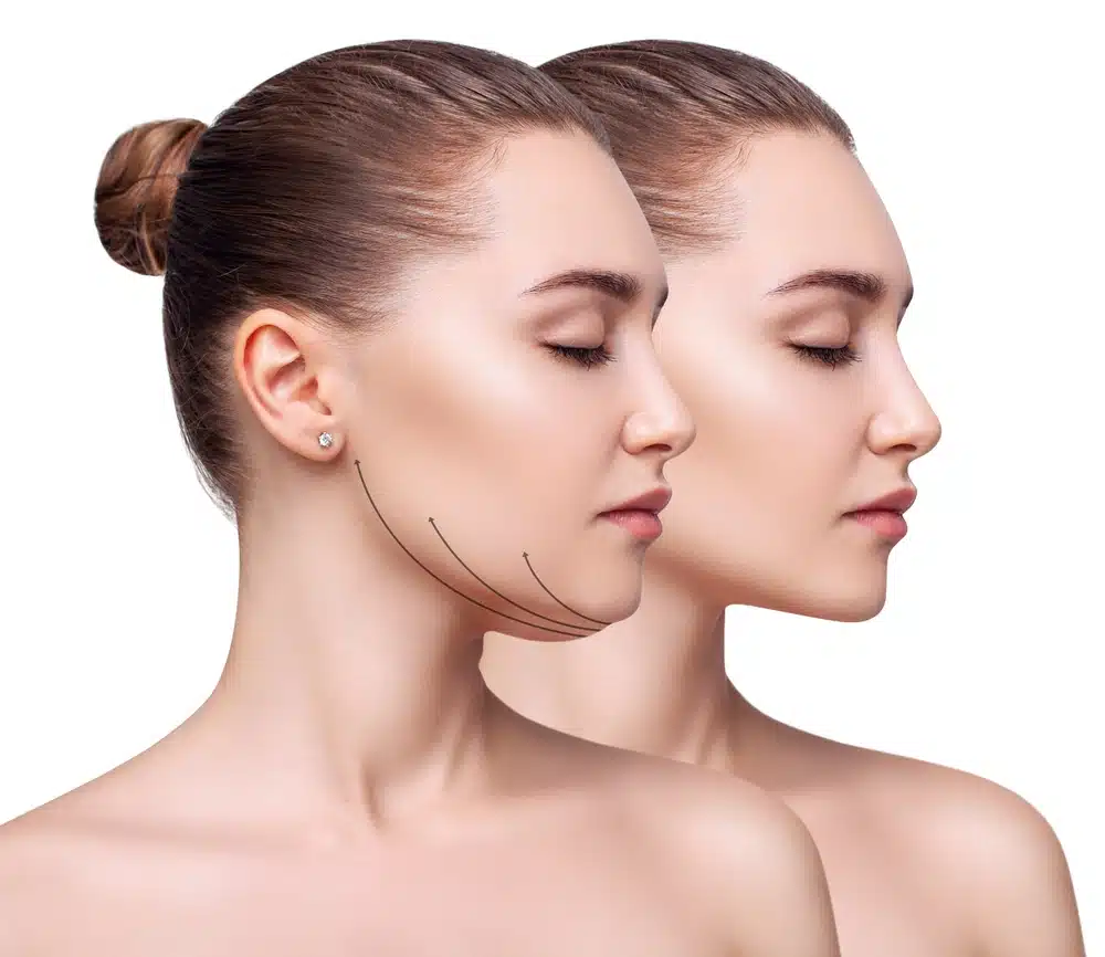 Neck Lipo Swelling: What to Expect During the Healing Process