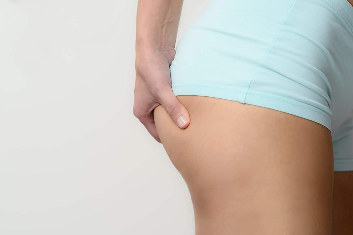 What Are The Side Effects of a Brazilian Butt Lift?