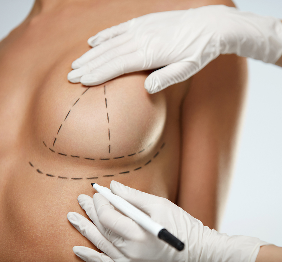 Over the years breasts can lose their shape and firmness due to pregnancy, nursing and loss of skin elasticity, causing them to sag