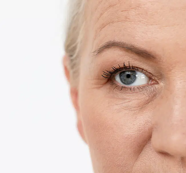 A brow lift is a cosmetic procedure designed to improve the appearance of the upper eyelids