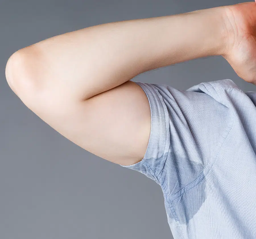 Overactive sweat glands can often cause a person to sweat uncontrollably.