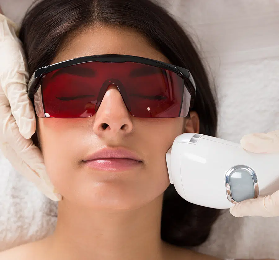 Isolaz Acne Light in Hudson Valley, NY