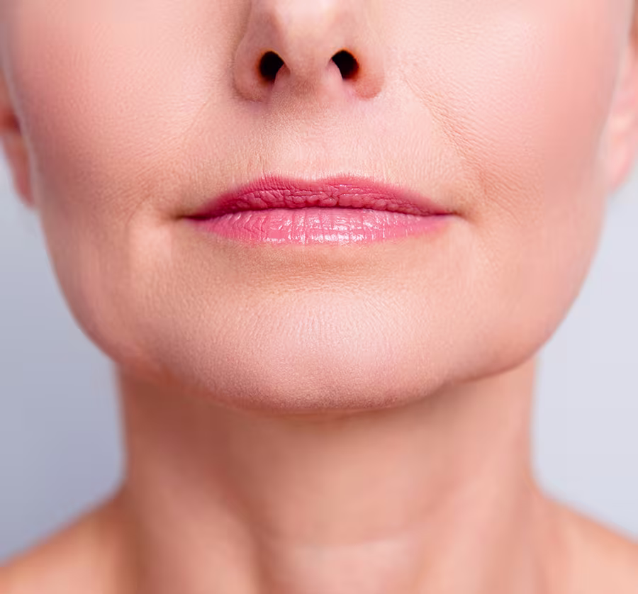 The upper lip begins to sag and droop with age