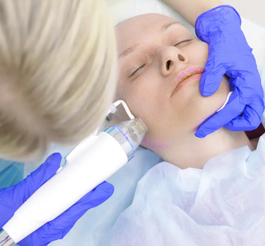 The Genius RF microneedling device offers many exciting benefits for patients