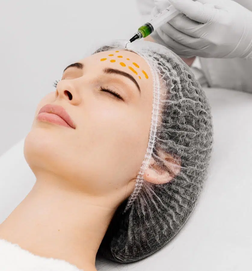 BioRePeel skin resurfacing treatment on forehead to improve tone, texture, and collagen production with minimal downtime.